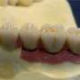 Laboratorio de prótesis Dental